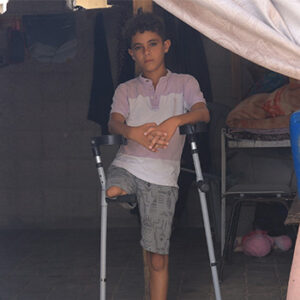 Contribute to Fitting a Prosthetic Limb for an Amputee Child